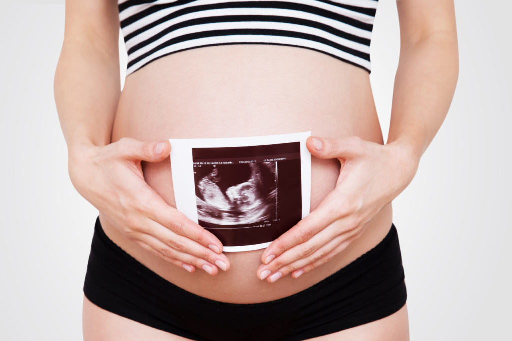 Image of a pregnant woman's belly. The woman is wearing a white and black striped crop top and black underwear. The woman is holding an ultrasound image in front of her pregnant belly.