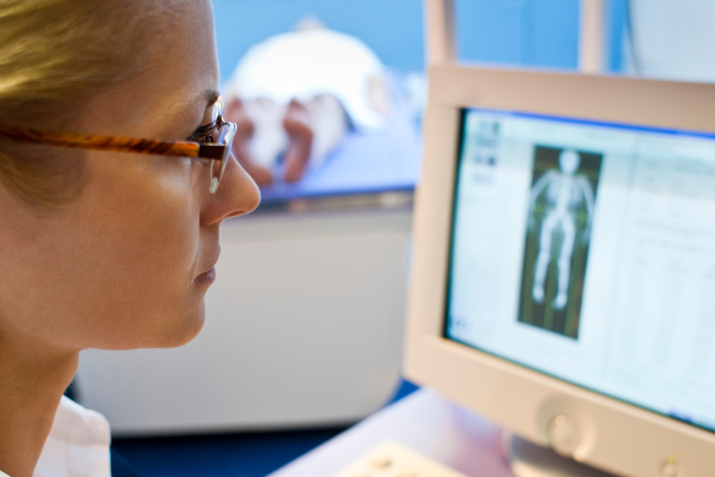 Image of a radiologist looking at a person's DEXA scan results on a computer screen. The radiologist is a woman and is wearing glasses. The computer screen has an x-ray image of a full skeleton.