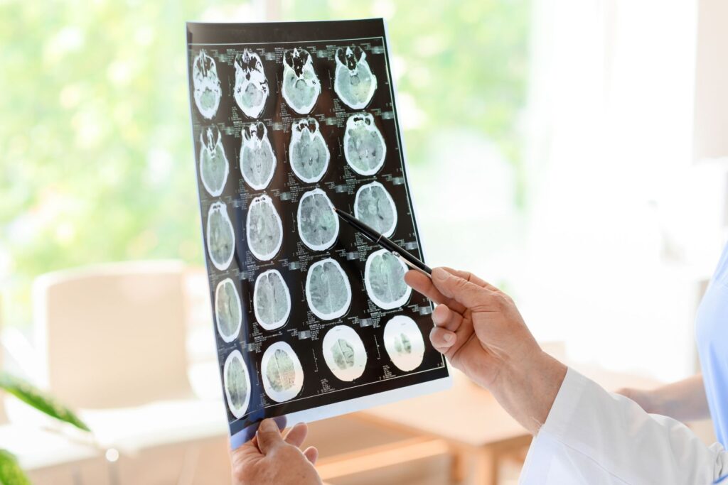 A doctor in a a white coat is holding up a brain scan of multiple images of a brain. They hold the scan up to the light of a window and are pointing at the middle of the page with a black pen. 